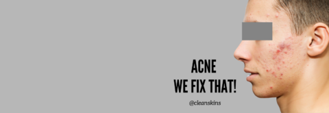 Read all about acne and how we can fix that!